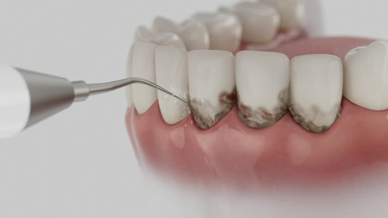 Reliable Wisdom Tooth Removal contractor in Essex County County, VA by Dentist Open Now